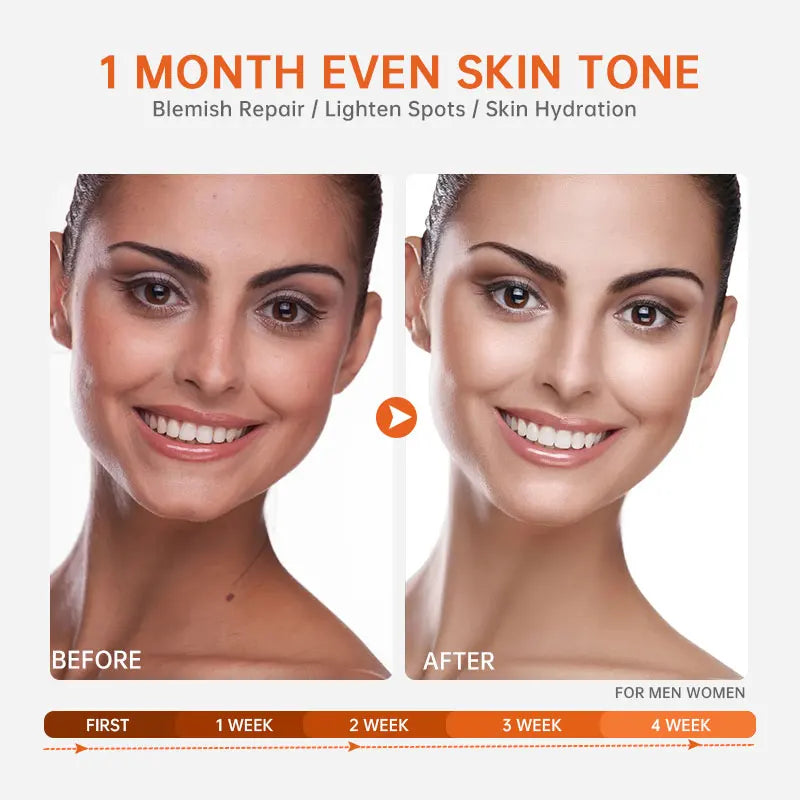 Acid Facial Essence Skin Care