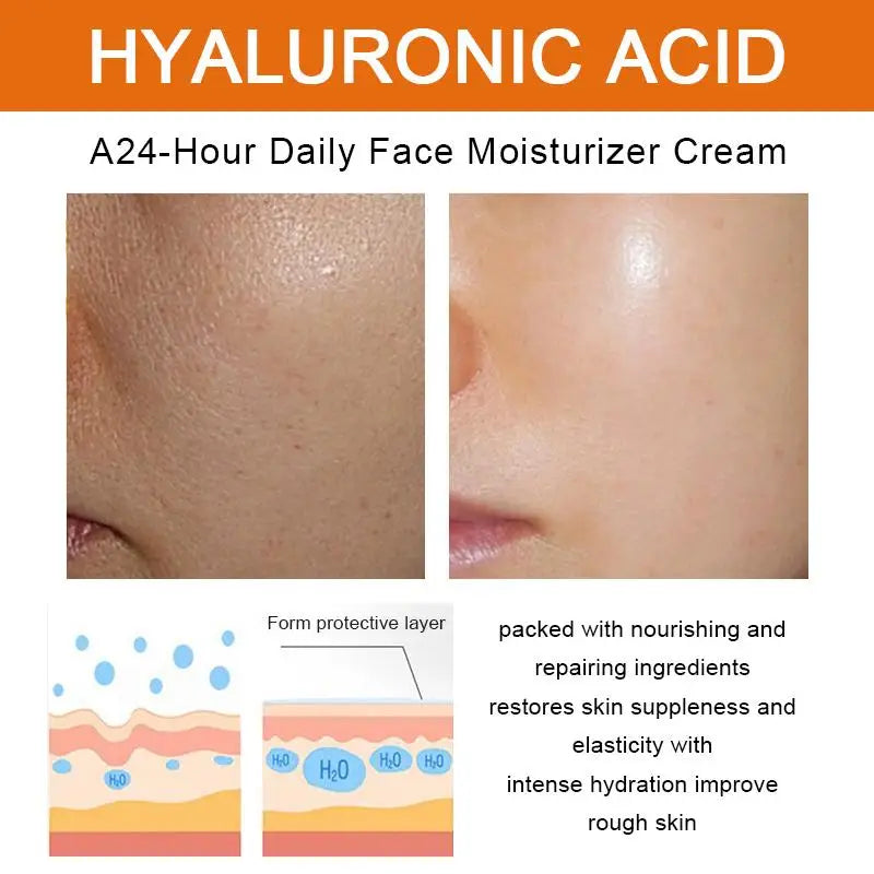 Face Cream Remove Dark Spots